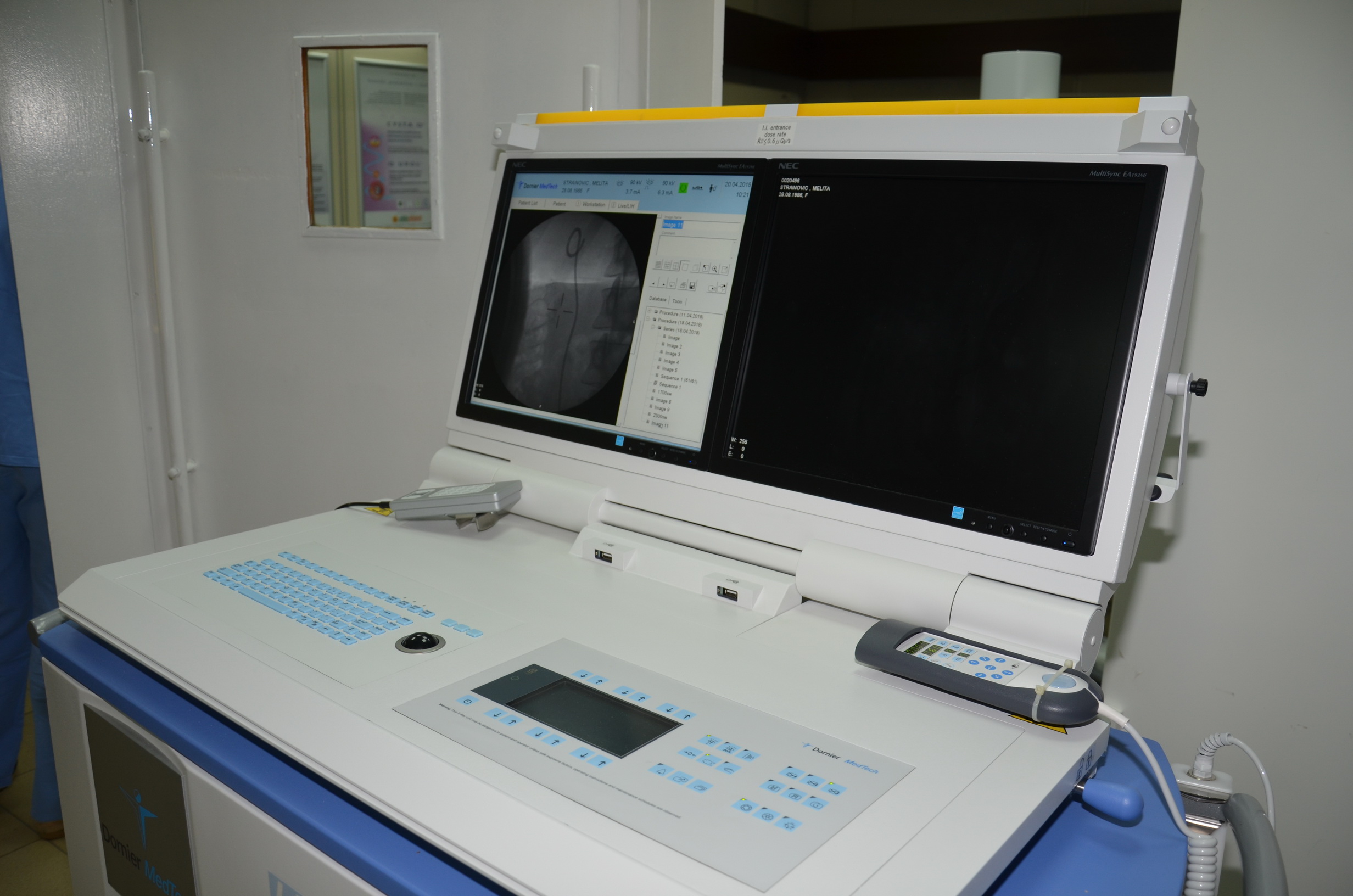 Najsavremeniji aparat za razbijanje kamena u bubregu u Kliničkom centru Srbije