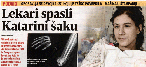 Lekari spasili šaku